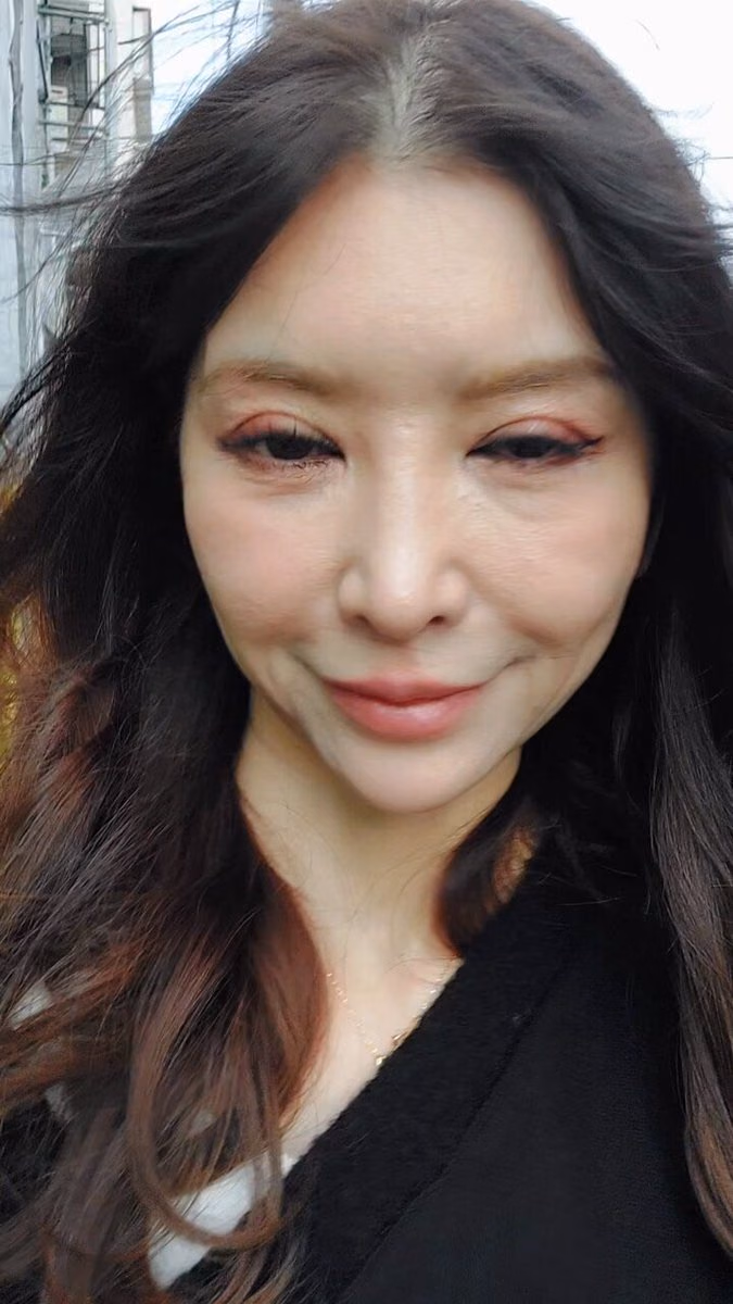 아이다 루카 35